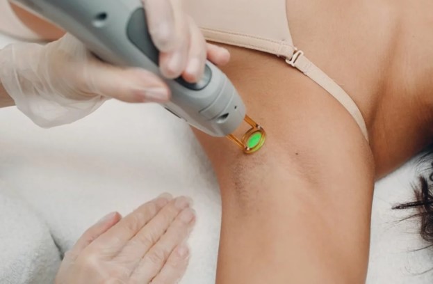 female laser treatment